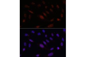 Immunofluorescence analysis of U2OS cells using Bcl9 Rabbit pAb (ABIN7265817) at dilution of 100 (40x lens). (BCL9 抗体)