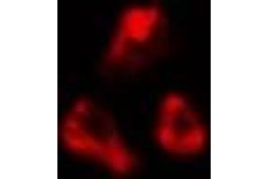 ABIN6277053 staining  LOVO cells by IF/ICC. (CDKN3 抗体  (Internal Region))