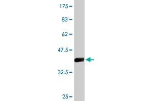 Western Blotting (WB) image for anti-Cleavage and Polyadenylation Specific Factor 3, 73kDa (CPSF3) (AA 585-684) antibody (ABIN526864)