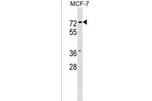 NOTUM Antibody (C-term) (ABIN1537190 and ABIN2849368) western blot analysis in MCF-7 cell line lysates (35 μg/lane). (NOTUM 抗体  (C-Term))