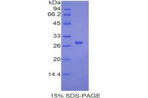 SDS-PAGE analysis of Mouse COMT Protein. (COMT 蛋白)