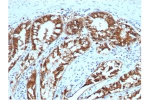 Formalin-fixed, paraffin-embedded canine (dog) colon stained with Ep-CAM Mouse Monoclonal Antibody (EGP40/1373).