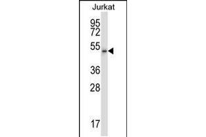 Western blot analysis in Jurkat cell line lysates (35ug/lane). (Cyclin-Dependent Kinase 15 (ALS2CR7) (AA 96-124), (N-Term) 抗体)