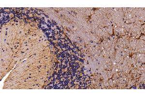 Immunohistochemistry (IHC) image for anti-Glial Fibrillary Acidic Protein (GFAP) (AA 1-430) antibody (ABIN7430750)