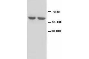 Image no. 2 for anti-Glutamate Decarboxylase 1 (Brain, 67kDa) (GAD1) (N-Term) antibody (ABIN1495050) (GAD 抗体  (N-Term))