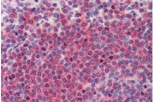 Human Spleen (formalin-fixed, paraffin-embedded) stained with  antibody ABIN462274 followed by biotinylated secondary antibody, alkaline phosphatase-streptavidin and chromogen. (BRCC3 抗体  (AA 1-316))