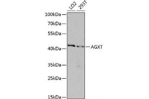 Western blot analysis of extracts of various cell lines using AGXT Polyclonal Antibody at dilution of 1:1000. (AGXT 抗体)
