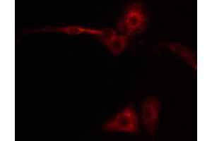 ABIN6267449 staining NIH-3T3 by IF/ICC. (CXCR2 抗体  (pSer347))