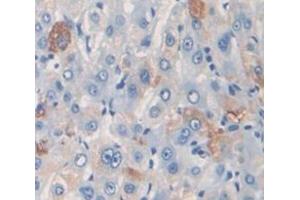 IHC-P analysis of Kidney tissue, with DAB staining. (PZP 抗体  (AA 1246-1495))