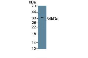 Detection of Recombinant Sarcolipin, Human using Polyclonal Antibody to Sarcolipin (SLN) (SLN 抗体  (AA 1-31))