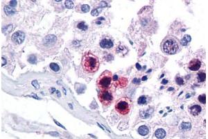 Human Testis: Formalin-Fixed, Paraffin-Embedded (FFPE) (RORC 抗体  (AA 110-159))