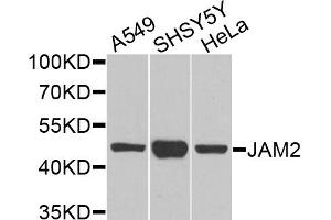 Western blot analysis of extracts of various cell lines, using JAM2 antibody. (JAM2 抗体)
