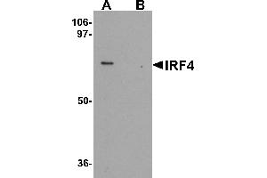 Western blot analysis of IRF4 in Jurkat cell lysate with IRF4 antibody at 1 µg/mL in (A) the absence and (B) the presence of blocking peptide. (IRF4 抗体  (C-Term))
