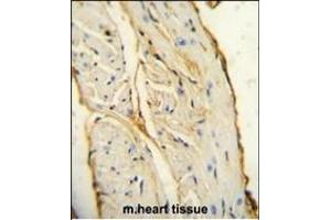 AIF1 antibody (N-term) (ABIN654407 and ABIN2844145) immunohistochemistry analysis in formalin fixed and paraffin embedded mouse heart tissue followed by peroxidase conjugation of the secondary antibody and DAB staining. (Iba1 抗体  (N-Term))