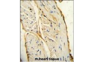 AIF1 antibody (N-term) (ABIN654407 and ABIN2844145) immunohistochemistry analysis in formalin fixed and paraffin embedded mouse heart tissue followed by peroxidase conjugation of the secondary antibody and DAB staining.
