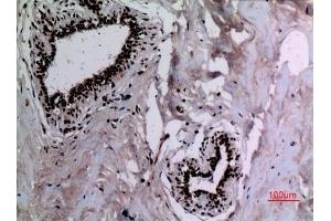 Immunohistochemical analysis of paraffin-embedded human-breast, antibody was diluted at 1:100. (HSP90 抗体  (acLys284, acLys292))