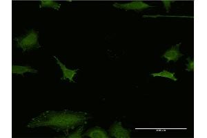 Immunofluorescence of monoclonal antibody to EFHD1 on HeLa cell. (EFHD1 抗体  (AA 168-238))