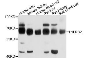 Western blot analysis of extracts of various cells, using LILRB2 antibody. (LILRB2 抗体)