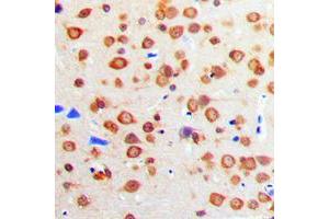 Immunohistochemical analysis of IGF1 Receptor staining in human brain formalin fixed paraffin embedded tissue section. (IGF1R 抗体  (C-Term))