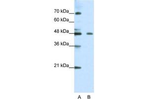 Western Blotting (WB) image for anti-Zinc Finger Protein 645 (ZNF645) antibody (ABIN2461310) (ZNF645 抗体)