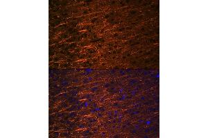Immunofluorescence analysis of rat brain using Alpha Internexin Rabbit mAb (ABIN7268012) at dilution of 1:100 (40x lens). (INA 抗体)