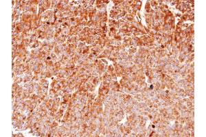 Immunohistochemistry (IHC) image for anti-Heat Shock Protein 90kDa alpha (Cytosolic), Class B Member 1 (HSP90AB1) (N-Term) antibody (ABIN2855047)