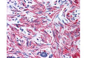 Anti-MYL9 antibody IHC of human smooth muscle. (MYL9 抗体  (AA 12-27))