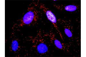 Proximity Ligation Analysis of protein-protein interactions between SYK and CTTN. (SYK 抗体  (AA 1-635))