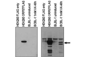Image no. 1 for anti-Herpes Virus Type 8 (HHV8) (C-Term) antibody (ABIN401445) (HHV8 抗体  (C-Term))