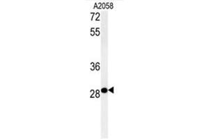 C11orf46 Antibody (C-term) western blot analysis in A2058 cell line lysates (35µg/lane). (C11orf46 抗体  (C-Term))