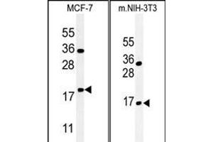 (LEFT)Western blot analysis of BTG1 Antibody (Center) (ABIN651304 and ABIN2840179) in MCF-7 cell line lysates (35 μg/lane). (BTG1 抗体  (AA 92-118))