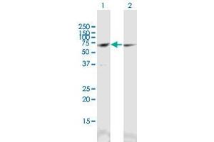 Western Blot analysis of CCT3 expression in transfected 293T cell line (CCT3 抗体  (AA 1-544))