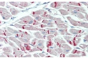 Detection of DSP in Human Heart Tissue using Polyclonal Antibody to Desmoplakin (DSP)