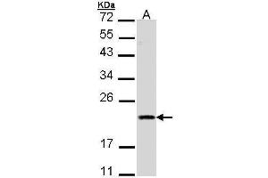 WB Image Sample (30 ug of whole cell lysate) A: A431 , 12% SDS PAGE antibody diluted at 1:1000 (DIABLO 抗体)