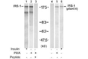 Image no. 2 for anti-Insulin Receptor Substrate 1 (IRS1) (pSer636) antibody (ABIN196979)