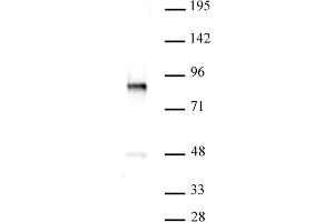 PKC-B antibody (pAb) tested by Western blot. (PKC beta 抗体  (C-Term))