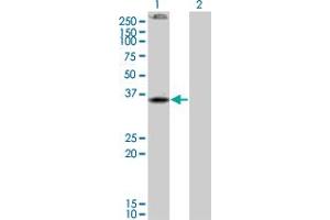 Western Blot analysis of CNR2 expression in transfected 293T cell line by CNR2 monoclonal antibody (M01), clone 3C7. (CNR2 抗体  (AA 302-360))