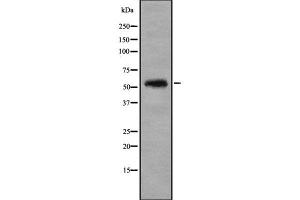 Western blot analysis of Cytochrome P450 46A1 using HuvEc whole cell lysates (CYP46A1 抗体)