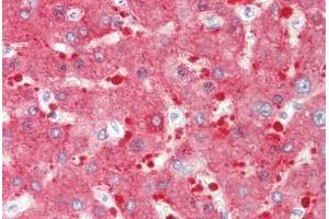 Human Liver: Formalin-Fixed, Paraffin-Embedded (FFPE)