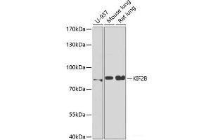 Western blot analysis of extracts of various cell lines using KIF2B Polyclonal Antibody at dilution of 1:1000. (KIF2B 抗体)