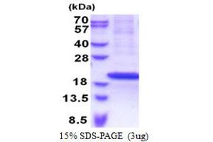 SDS-PAGE (SDS) image for Ribosomal Protein S18 (RPS18) (AA 1-152) protein (His tag) (ABIN5853308) (RPS18 Protein (AA 1-152) (His tag))