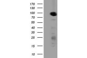 Western Blotting (WB) image for anti-Protein Kinase D2 (PKD2) antibody (ABIN1500410) (PKD2 抗体)