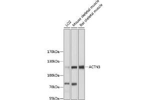 Western blot analysis of extracts of various cell lines, using  antibody  at 1:3000 dilution. (ACTN3 抗体  (AA 580-630))