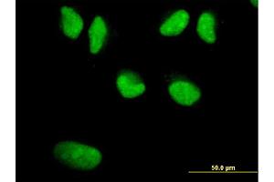 Immunofluorescence (IF) image for anti-Werner syndrome RecQ like helicase (WRN) (AA 1322-1432) antibody (ABIN521400)