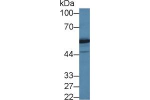 Detection of DARS in Human Jurkat cell lysate using Polyclonal Antibody to Aspartyl tRNA Synthetase (DARS)