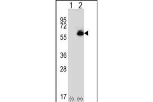 Western Blotting (WB) image for anti-Aldehyde Dehydrogenase 4 Family, Member A1 (ALDH4A1) (AA 533-561), (C-Term) antibody (ABIN392356)