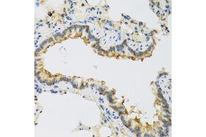 Immunohistochemistry of paraffin-embedded rat lung using FAM20A antibody (ABIN5974869) at dilution of 1/100 (40x lens). (FAM20A 抗体)