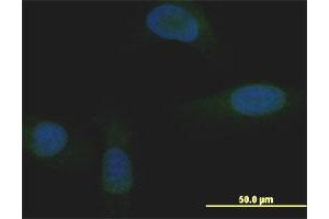 Immunofluorescence of monoclonal antibody to MXI1 on U-2 OS cell. (MXI1 抗体  (AA 1-182))