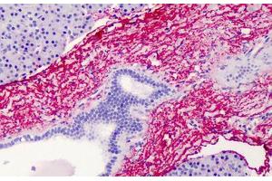 Human Pancreas: Formalin-Fixed, Paraffin-Embedded (FFPE) (Elastin 抗体)