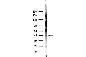 anti-Tropomodulin 2 (TMOD2) (N-Term) antibody